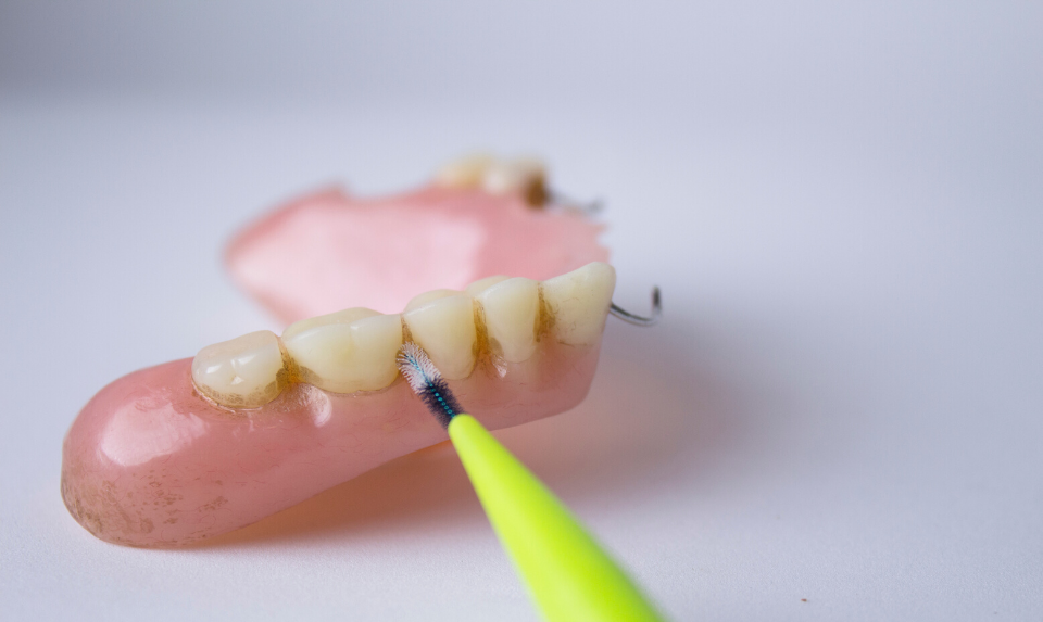 How Do You Take Care of Your Dentures? - A Gateway to Healthier Living